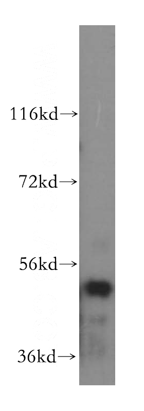 HeLa cells were subjected to SDS PAGE followed by western blot with Catalog No:114971(SARS2 antibody) at dilution of 1:500