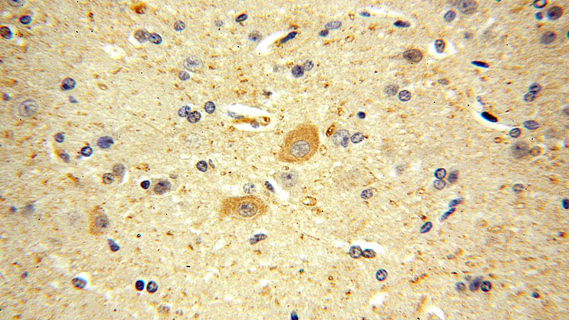 Immunohistochemical of paraffin-embedded human brain using Catalog No:111924(KCNAB1 antibody) at dilution of 1:100 (under 40x lens)