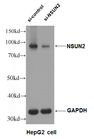 WB result of NSUN2 antibody (Catalog No:113388, 1:5000) with si-Control and si-NSUN2 transfected HepG2 cells.