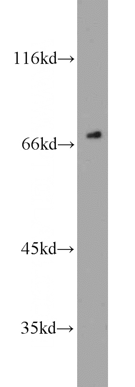 K-562 cells were subjected to SDS PAGE followed by western blot with Catalog No:111557(HSF1 antibody) at dilution of 1:1000