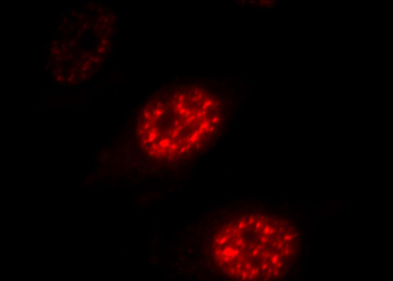 Immunofluorescent analysis of HepG2 cells, using DDX39 antibody Catalog No:109828 at 1:25 dilution and Rhodamine-labeled goat anti-rabbit IgG (red).