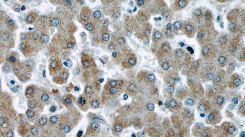Immunohistochemical of paraffin-embedded human liver using Catalog No:107485(PHB antibody) at dilution of 1:50 (under 40x lens)