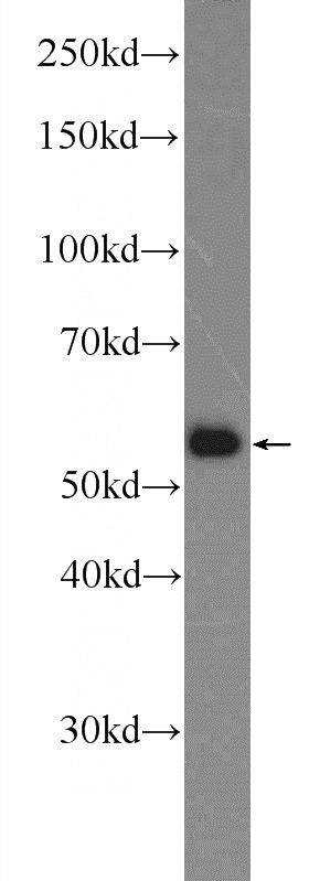 HepG2 cells were subjected to SDS PAGE followed by western blot with Catalog No:115040(SAAL1 Antibody) at dilution of 1:600