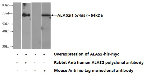 Transfected HEK-293 cells were subjected to SDS PAGE followed by western blot with Catalog No:107954(ALAS2 Antibody) at dilution of 1:700