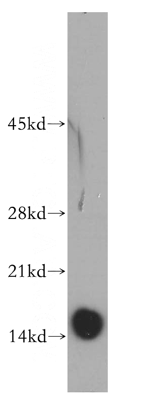 mouse skeletal muscle tissue were subjected to SDS PAGE followed by western blot with Catalog No:113828(FXYD1 antibody) at dilution of 1:200