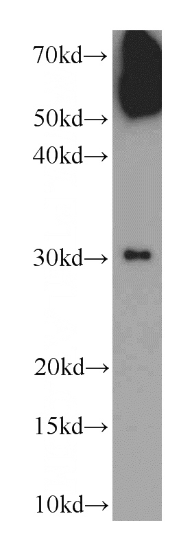 SGC-7901 cells were subjected to SDS PAGE followed by western blot with Catalog No:116971(WSB1 antibody) at dilution of 1:1000