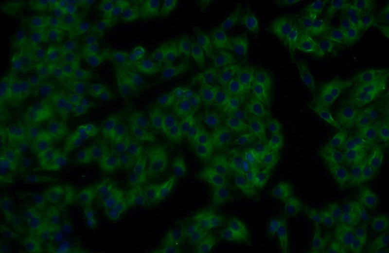 Immunofluorescent analysis of A375 cells using Catalog No:114864(RTN4 Antibody) at dilution of 1:25 and Alexa Fluor 488-congugated AffiniPure Goat Anti-Rabbit IgG(H+L)