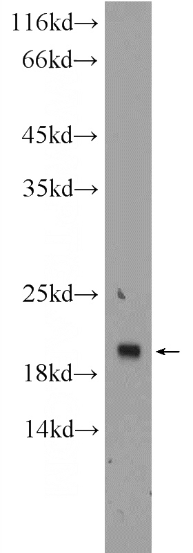 HEK-293 cells were subjected to SDS PAGE followed by western blot with Catalog No:116183(TMEM27 Antibody) at dilution of 1:300