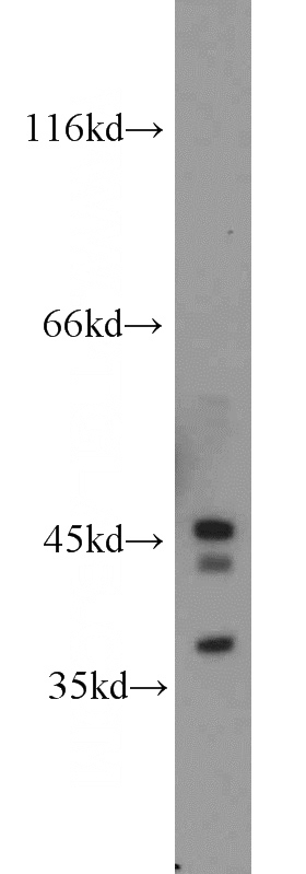 mouse liver tissue were subjected to SDS PAGE followed by western blot with Catalog No:113488(PAFAH2 antibody) at dilution of 1:300