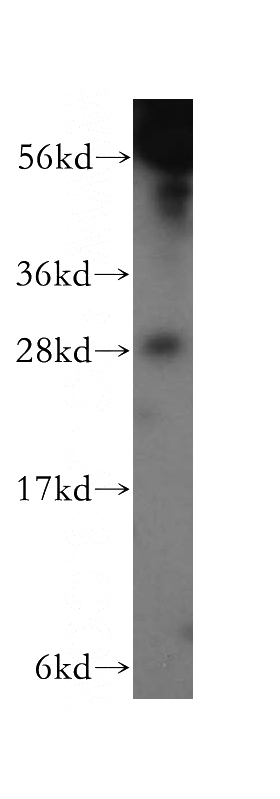 A375 cells were subjected to SDS PAGE followed by western blot with Catalog No:110866(GAR1 antibody) at dilution of 1:300