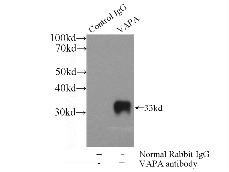 IP Result of anti-VAPA (IP:Catalog No:116714, 3ug; Detection:Catalog No:116714 1:1000) with HEK-293 cells lysate 3200ug.