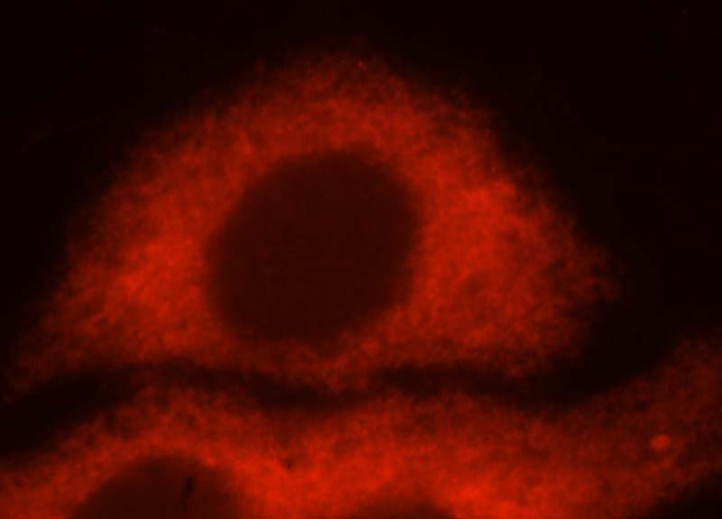 Immunofluorescent analysis of HepG2 cells, using RPS12 antibody Catalog No:114827 at 1:25 dilution and Rhodamine-labeled goat anti-rabbit IgG (red).