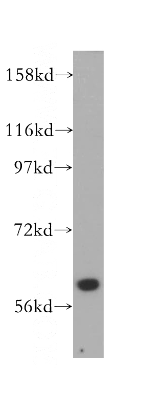 K-562 cells were subjected to SDS PAGE followed by western blot with Catalog No:107683(ABCB10 antibody) at dilution of 1:500