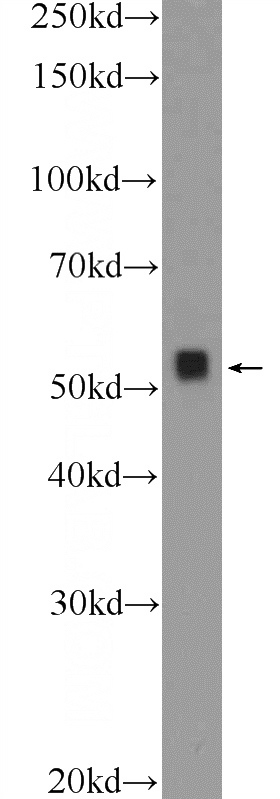 Y79 cells were subjected to SDS PAGE followed by western blot with Catalog No:110154(E2F3 Antibody) at dilution of 1:600