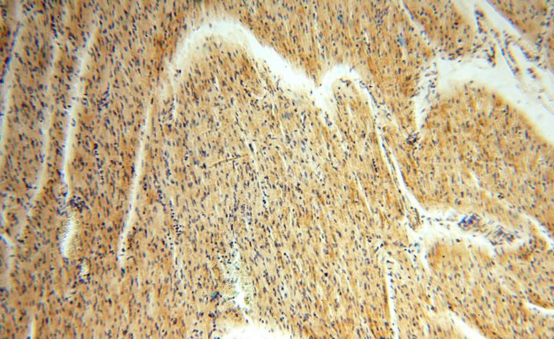 Immunohistochemical of paraffin-embedded human heart using Catalog No:109401(CLPP antibody) at dilution of 1:50 (under 10x lens)