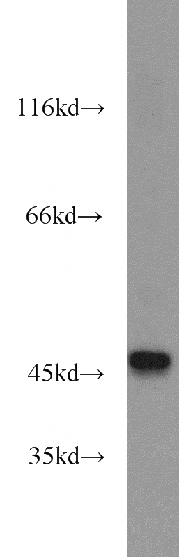 mouse brain tissue were subjected to SDS PAGE followed by western blot with Catalog No:114871(RUNDC3A antibody) at dilution of 1:2000