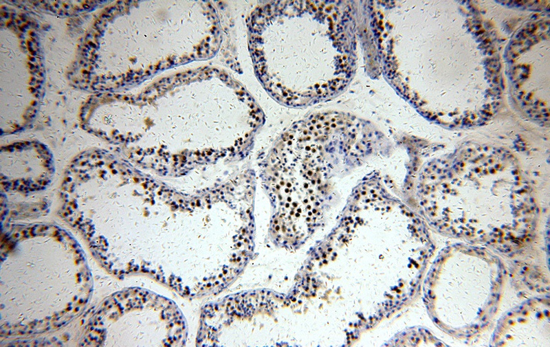 Immunohistochemical of paraffin-embedded human testis using Catalog No:114633(RFWD3 antibody) at dilution of 1:400 (under 10x lens)