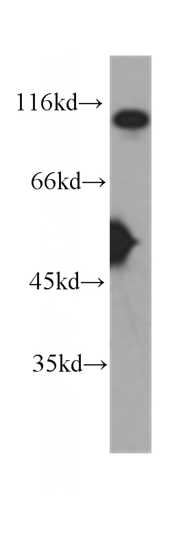 COLO 320 cells were subjected to SDS PAGE followed by western blot with Catalog No:107430(MSH2 antibody) at dilution of 1:1000