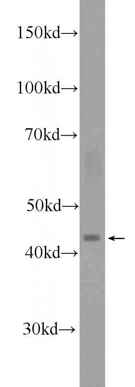 COLO 320 cells were subjected to SDS PAGE followed by western blot with Catalog No:115400(SMPDL3B Antibody) at dilution of 1:300