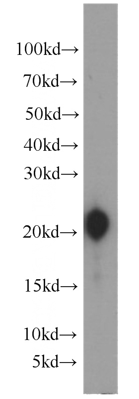 human stomach tissue were subjected to SDS PAGE followed by western blot with Catalog No:110876(GKN1 antibody) at dilution of 1:2000
