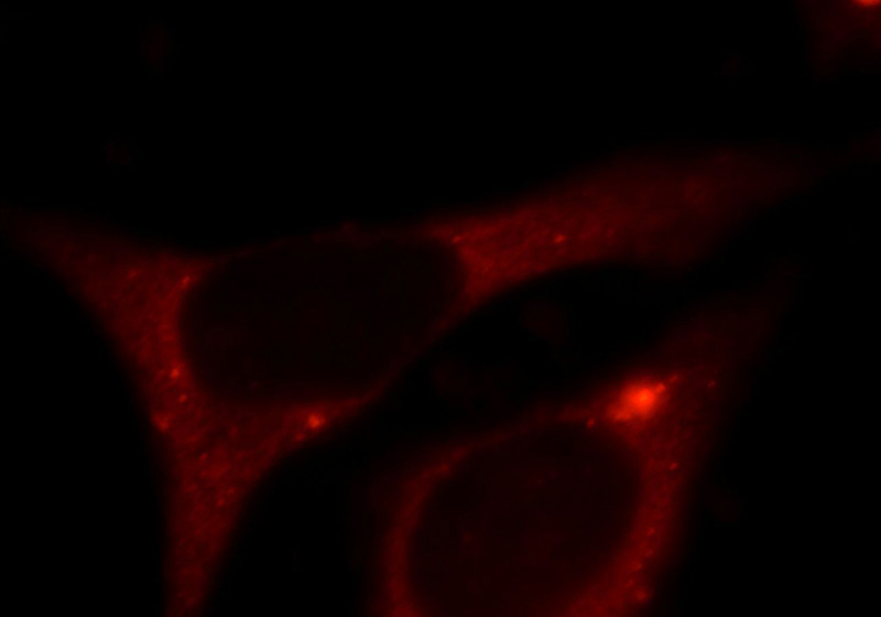Immunofluorescent analysis of HepG2 cells, using C5AR1 antibody Catalog No:108734 at 1:25 dilution and Rhodamine-labeled goat anti-rabbit IgG (red).