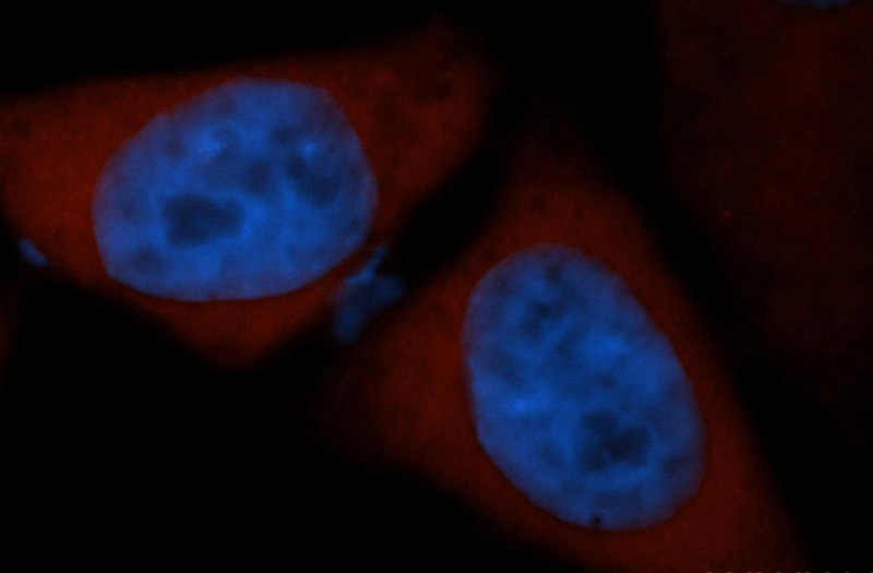 Immunofluorescent analysis of HepG2 cells, using COMT antibody Catalog No:109448 at 1:50 dilution and Rhodamine-labeled goat anti-rabbit IgG (red). Blue pseudocolor = DAPI (fluorescent DNA dye).