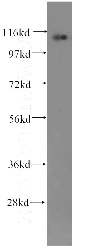 Jurkat cells were subjected to SDS PAGE followed by western blot with Catalog No:107181(CTAGE1 antibody) at dilution of 1:500
