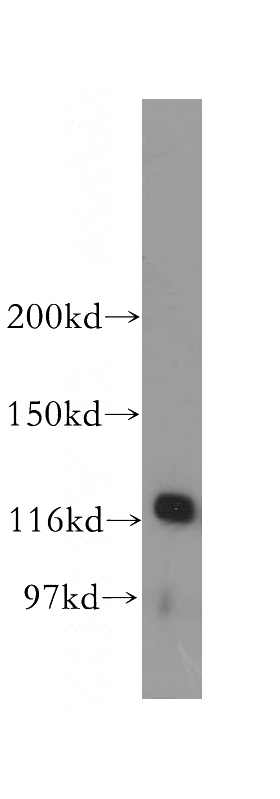 mouse testis tissue were subjected to SDS PAGE followed by western blot with Catalog No:113531(RBL1 antibody) at dilution of 1:500