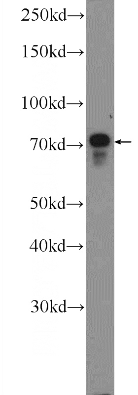 HepG2 cells were subjected to SDS PAGE followed by western blot with Catalog No:114407(RAB11FIP1 Antibody) at dilution of 1:600