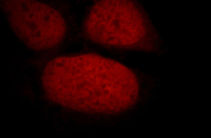 Immunofluorescent analysis of 293 cells, using STAG2 antibody Catalog No:115671 at 1:25 dilution and Rhodamine-labeled goat anti-rabbit IgG (red).