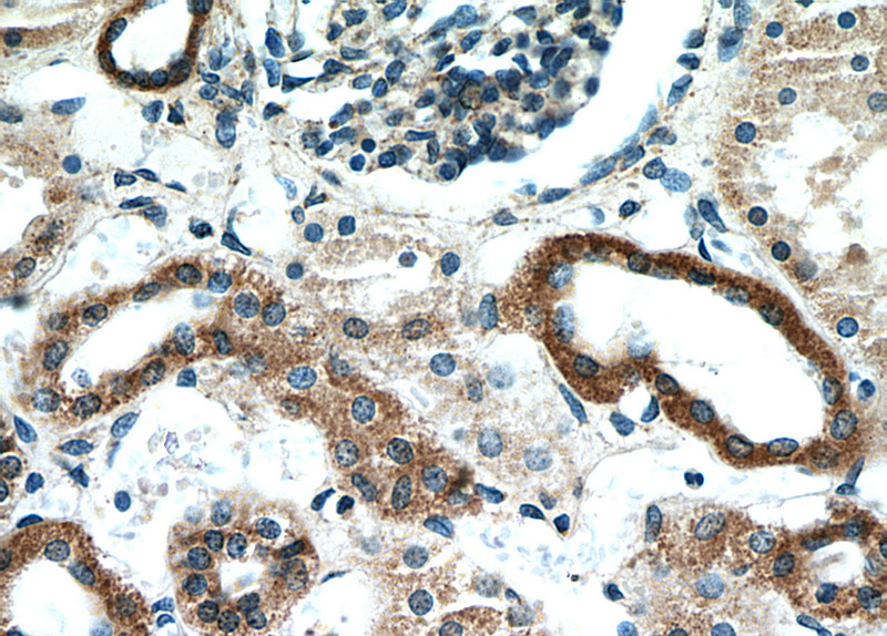 Immunohistochemical of paraffin-embedded human kidney using Catalog No:115970(CCDC44 antibody) at dilution of 1:50 (under 40x lens)