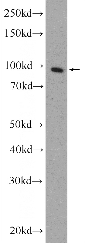 HeLa cells were subjected to SDS PAGE followed by western blot with Catalog No:116337(TNPO1 Antibody) at dilution of 1:300