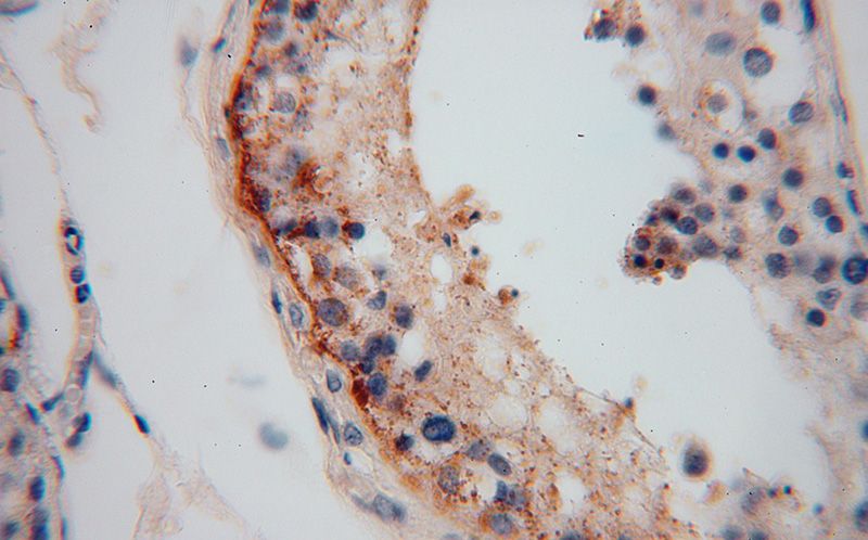 Immunohistochemical of paraffin-embedded human testis using Catalog No:112339(LRRTM1 antibody) at dilution of 1:100 (under 40x lens)