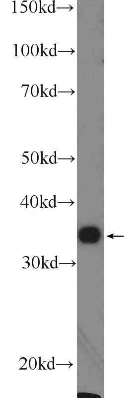mouse liver tissue were subjected to SDS PAGE followed by western blot with Catalog No:110717(FOXS1 Antibody) at dilution of 1:600