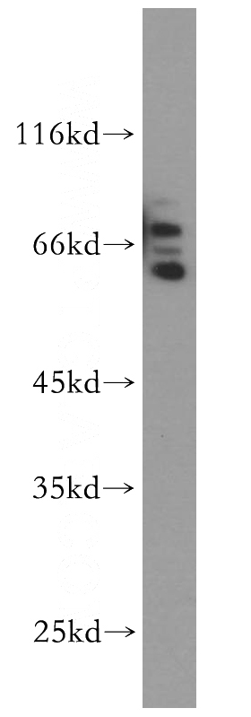A431 cells were subjected to SDS PAGE followed by western blot with Catalog No:115780(SYNCRIP antibody) at dilution of 1:500