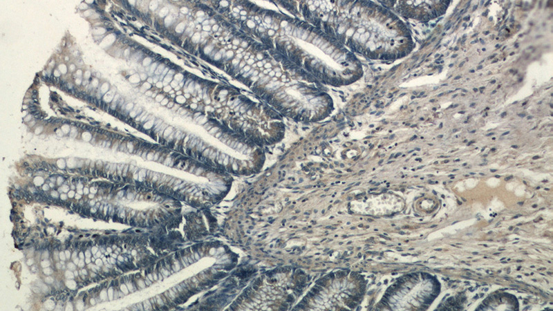 Immunohistochemical of paraffin-embedded human colon using Catalog No:108730(C4orf14 antibody) at dilution of 1:100 (under 10x lens)