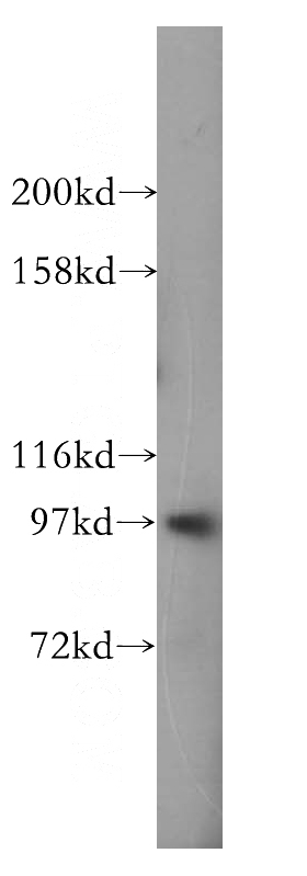 MCF7 cells were subjected to SDS PAGE followed by western blot with Catalog No:109861(EIF4G2 antibody) at dilution of 1:400