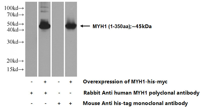 Transfected HEK-293 cells were subjected to SDS PAGE followed by western blot with Catalog No:112928(MYH1 Antibody) at dilution of 1:1000