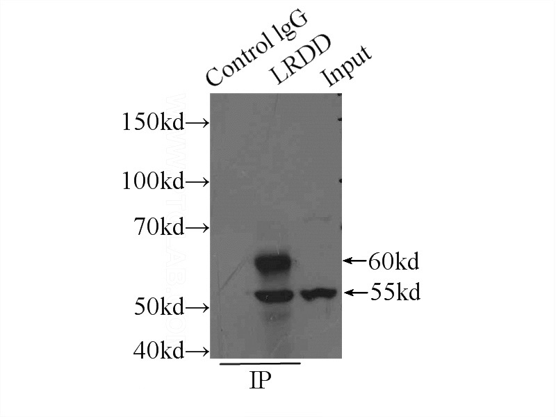 IP Result of anti-LRDD (IP:Catalog No:112317, 4ug; Detection:Catalog No:112317 1:500) with L02 cells lysate 2800ug.