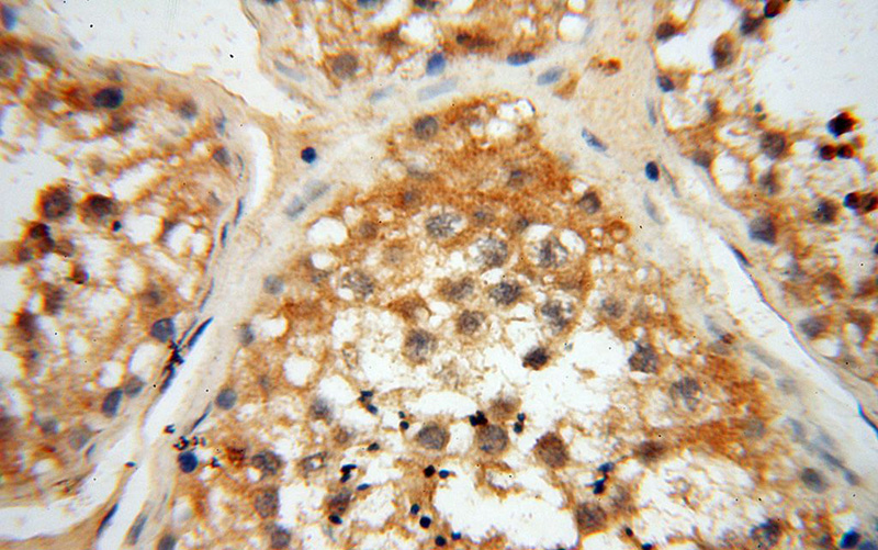 Immunohistochemical of paraffin-embedded human testis using Catalog No:114860(RTKN2 antibody) at dilution of 1:50 (under 40x lens)