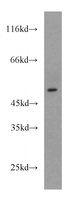 mouse brain tissue were subjected to SDS PAGE followed by western blot with Catalog No:111436(HMBOX1 antibody) at dilution of 1:1000