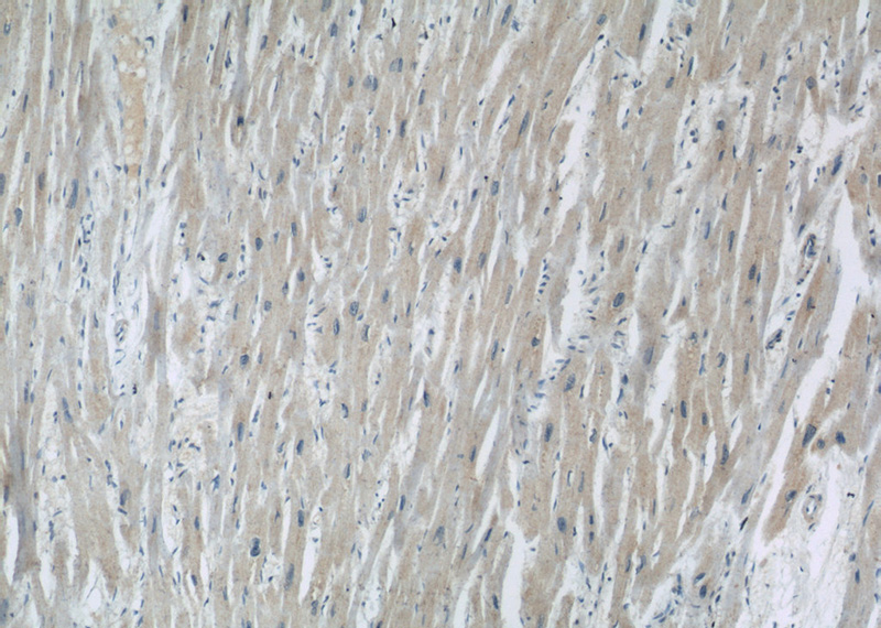Immunohistochemistry of paraffin-embedded human heart slide using Catalog No:107416(MBIP Antibody) at dilution of 1:50