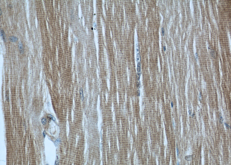 Immunohistochemical of paraffin-embedded human skeletal muscle using Catalog No:112913(MYBPC1 antibody) at dilution of 1:50 (under 40x lens)