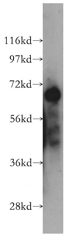 human liver tissue were subjected to SDS PAGE followed by western blot with Catalog No:108261(ARHGAP15 antibody) at dilution of 1:500