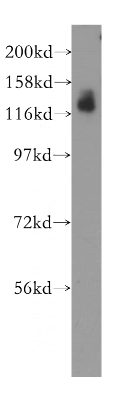 HEK-293 cells were subjected to SDS PAGE followed by western blot with Catalog No:115341(SLC4A4 antibody) at dilution of 1:400