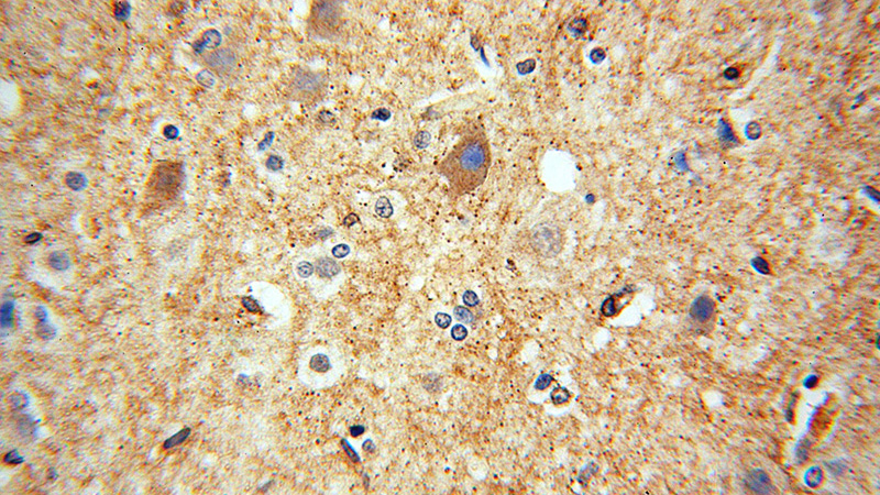 Immunohistochemical of paraffin-embedded human brain using Catalog No:111761(IMPA1 antibody) at dilution of 1:50 (under 40x lens)