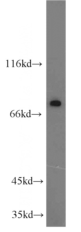 PC-3 cells were subjected to SDS PAGE followed by western blot with Catalog No:111973(KCNK5 antibody) at dilution of 1:800