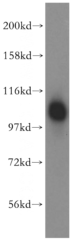 Jurkat cells were subjected to SDS PAGE followed by western blot with Catalog No:110585(FAM29A antibody) at dilution of 1:500