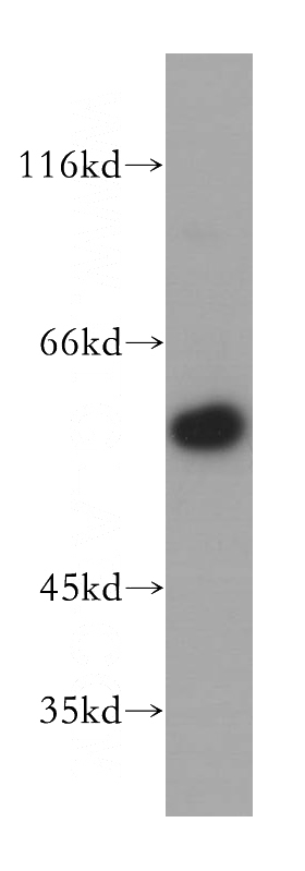 mouse lung tissue were subjected to SDS PAGE followed by western blot with Catalog No:114632(RFTN2 antibody) at dilution of 1:500