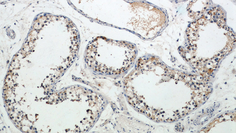 Immunohistochemical of paraffin-embedded human testis using Catalog No:112235(LIN41 antibody) at dilution of 1:50 (under 10x lens)